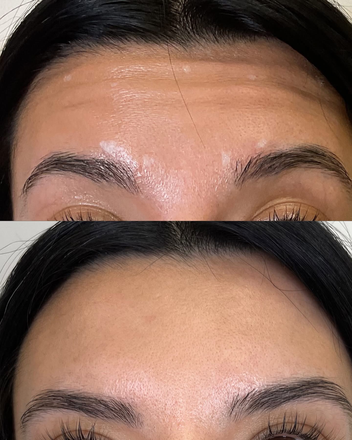 injectables-gallery-1