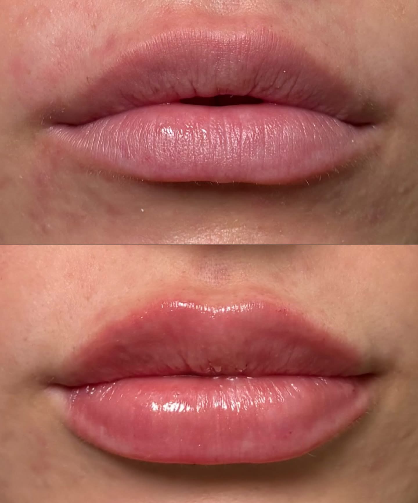 injectables-gallery-7