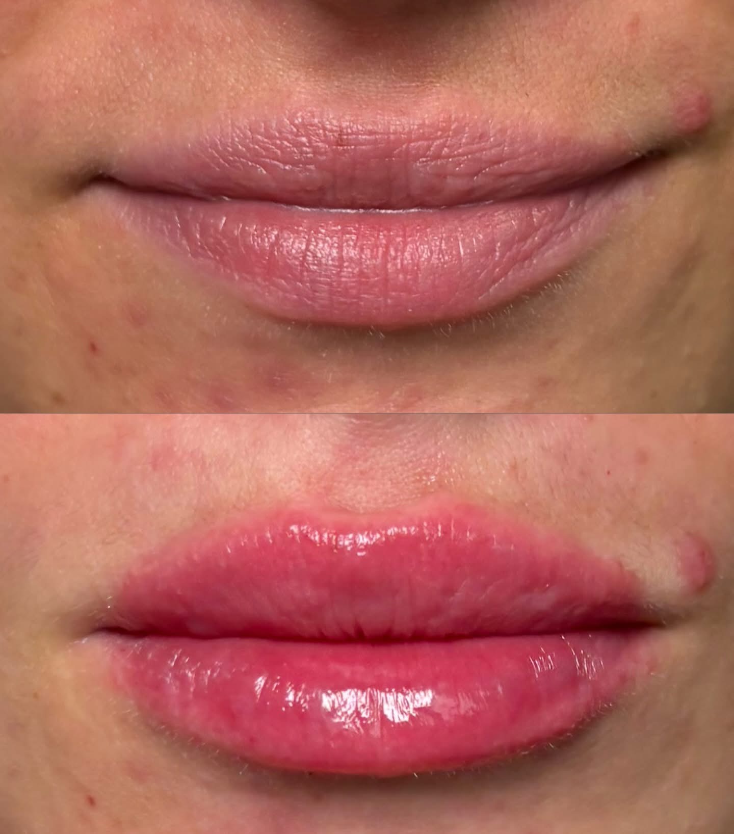 injectables-gallery-8